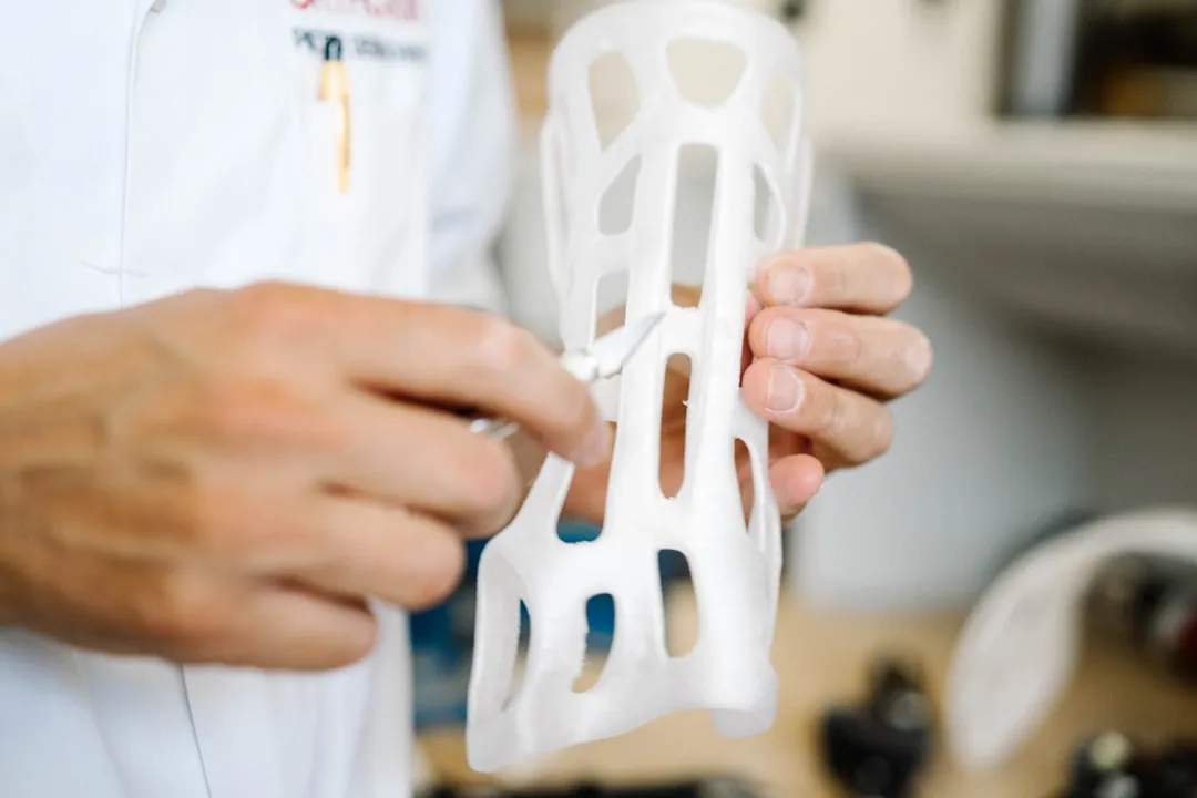Prótesis Impresas en 3D Transforman la Movilidad con Personalización de Ajuste Preciso
