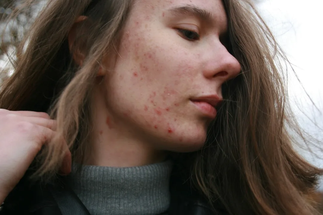 Woman applying spot treatment layering technique to targeted blemish area